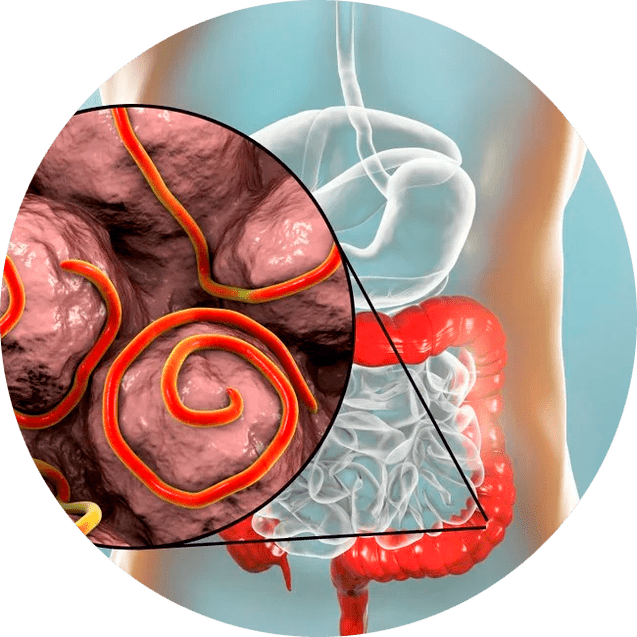 A gyomor-bél traktus és a paraziták