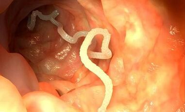 Az emberi szervezetben előforduló paraziták okai